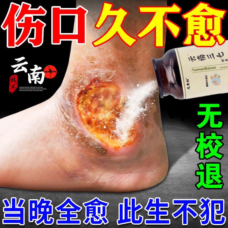 生肌粉三七伤口愈合金疮药皮肤溃烂老不好腐促进长肉消炎膏
