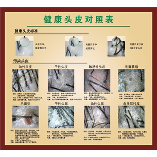 健康头皮对照表海报展板把根留住洗发露挂图无痕毛囊移植术墙贴