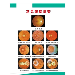 眼球结构图眼科知识眼镜店海报验光配镜流程图宣传画广告装饰画