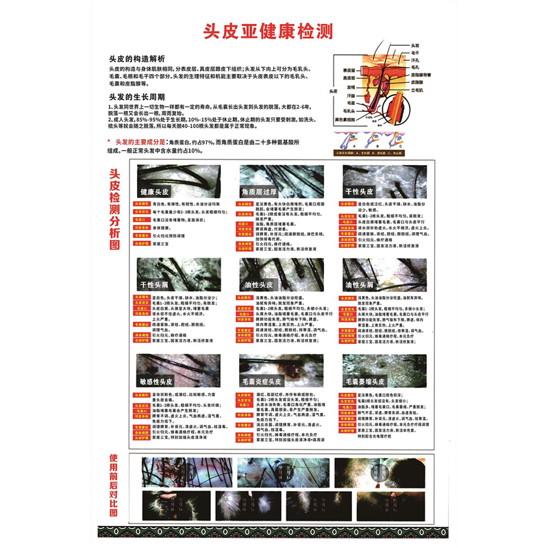 头皮亚健康检测海报展板头皮毛囊分析对比图头皮检测区墙贴墙纸,家居饰品,软装墙贴,淘宝优惠券,粉丝福利购,淘宝优惠卷