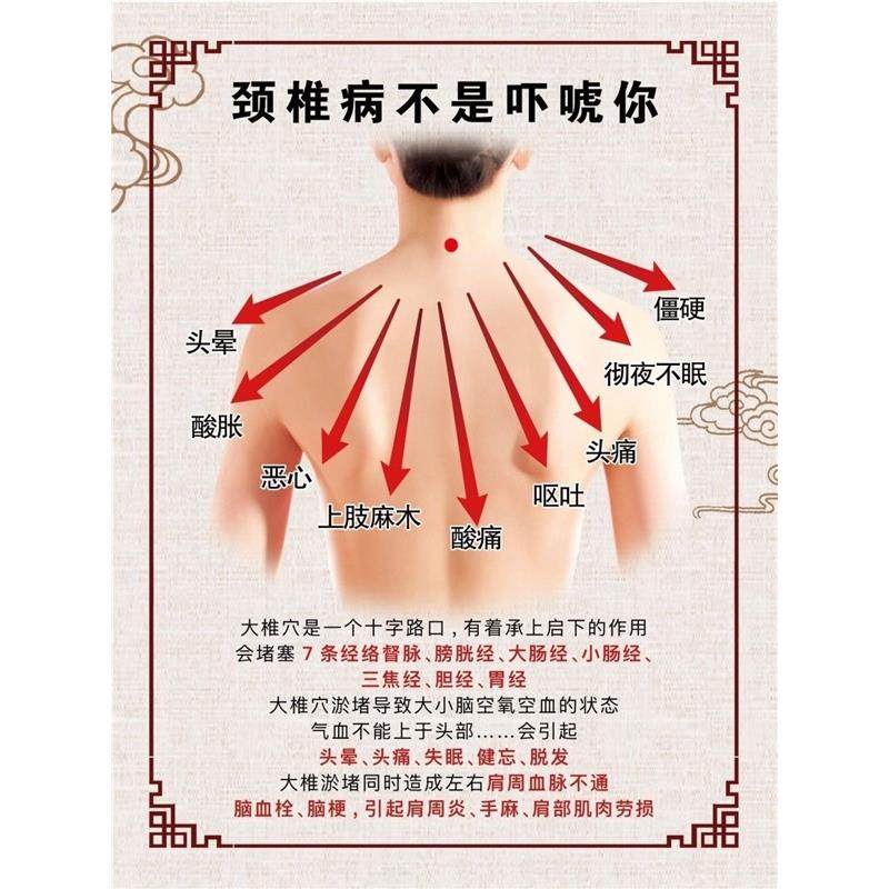 颈椎疾病的危害肩颈保养中医养生馆宣传海报美容院挂图KT板定制,个性定制/设计服务/DIY,写真/海报印制,淘宝优惠券,粉丝福利购,淘宝优惠卷