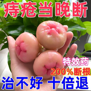 痔疮特效药膏德国进口消肉球根断便血肿胀疼痛外痔内痔混合痔专用