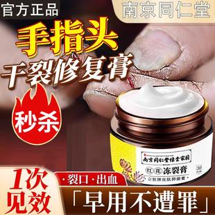 同仁堂手指头裂口子干裂修复开裂脱皮裂开手足手脚冬季皲裂膏保湿
