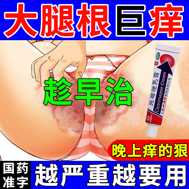 股藓专用药膏克霉唑乳膏男性女性股廯大腿内侧真菌感染瘙痒止痒膏