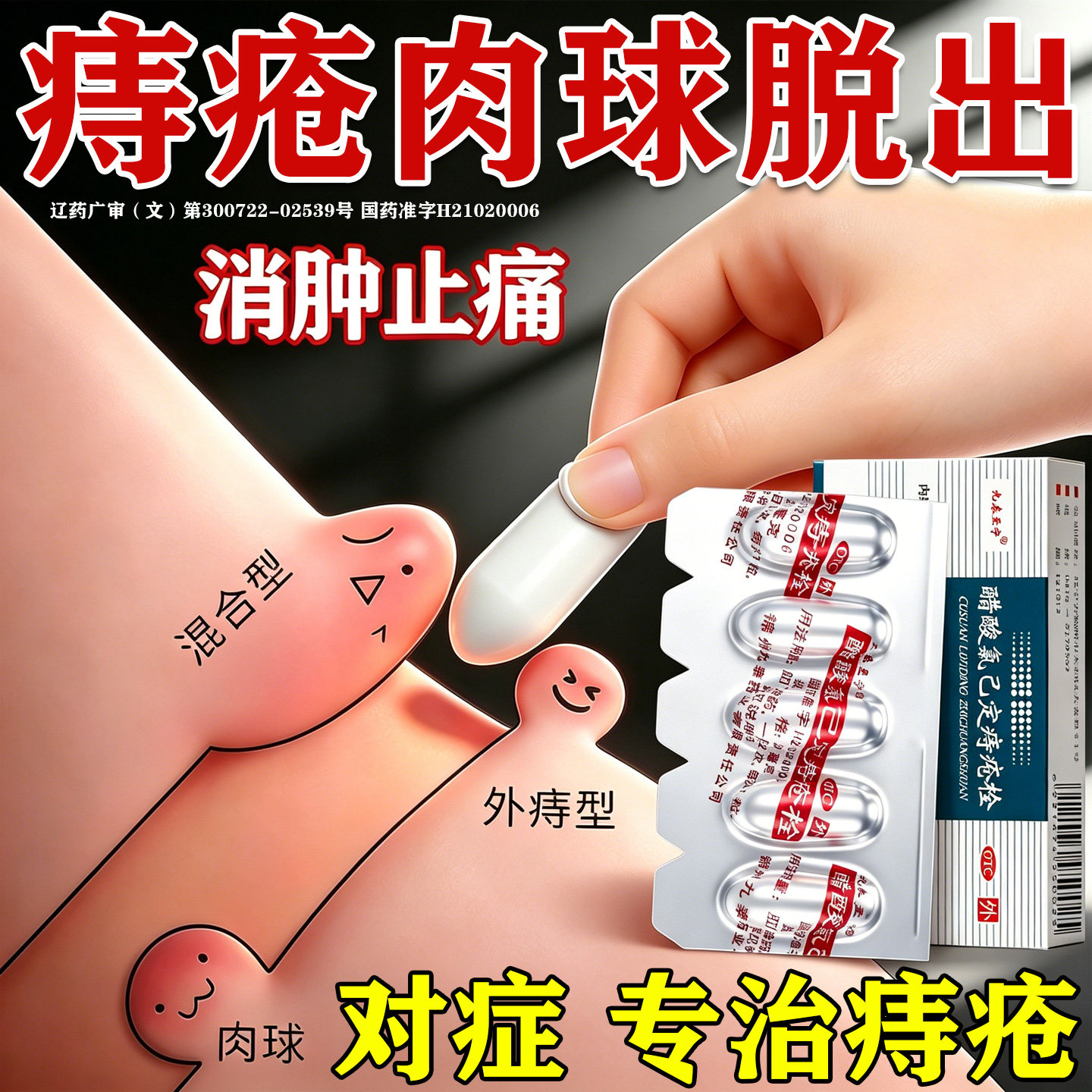 [东信]醋酸氯已定痔疮栓20mg*10粒/盒搭马应龙痔疮膏药痔疮栓