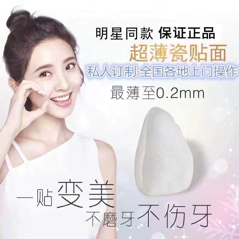 全瓷贴面义获嘉工厂超薄牙贴面定制美牙美白牙缝遮盖陶瓷牙齿贴片