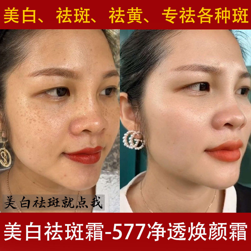 美白祛斑霜强效熊果苷淡化黄褐斑色斑雀斑老年斑黑色素遮瑕淡斑霜