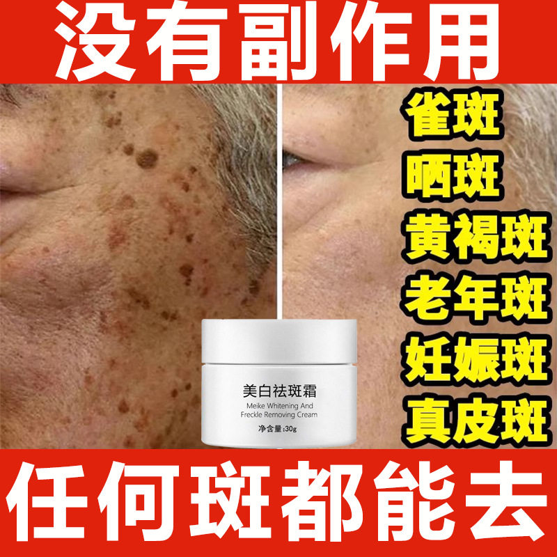 国妆特字美白祛斑霜强效去雀斑去黑色素黄褐斑老年斑祛斑炸斑白霜