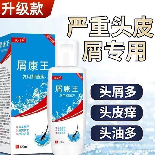 屑康王洗发水去屑止痒控油除螨抑菌液洗发膏见包装