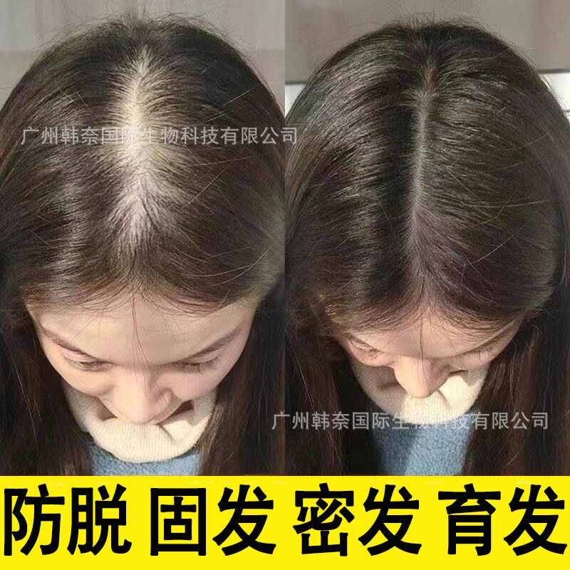 防脱育发液生发液何首乌修复头皮防脱密发强韧发根营养液固发护发