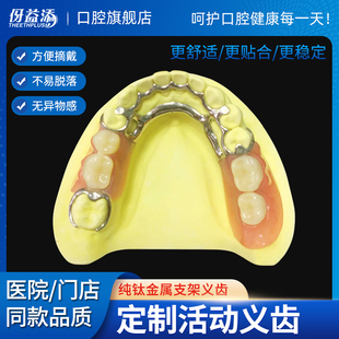 定制假牙义齿金属支架义齿活动隐形义齿临时活动牙全口假牙可拆卸