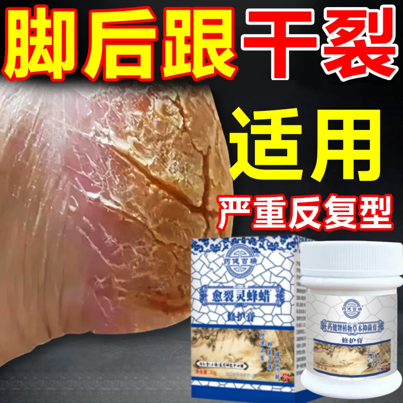 【防干裂神器】治脚后跟干裂去死皮手足滋润补水保湿防裂口修复膏