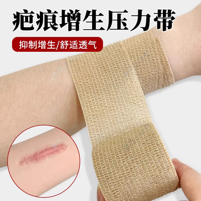 疤痕增生压力带大小腿烧伤疤痕