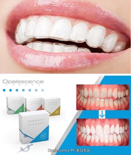 迅美定制Opalescence美国皓齿美白牙套牙托盘美白剂过氧化脲凝胶