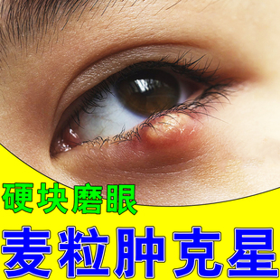 麦粒肿眼药水睑腺炎针眼红肿磨着疼痛有硬结黄色脓点眼睛痒滴眼液