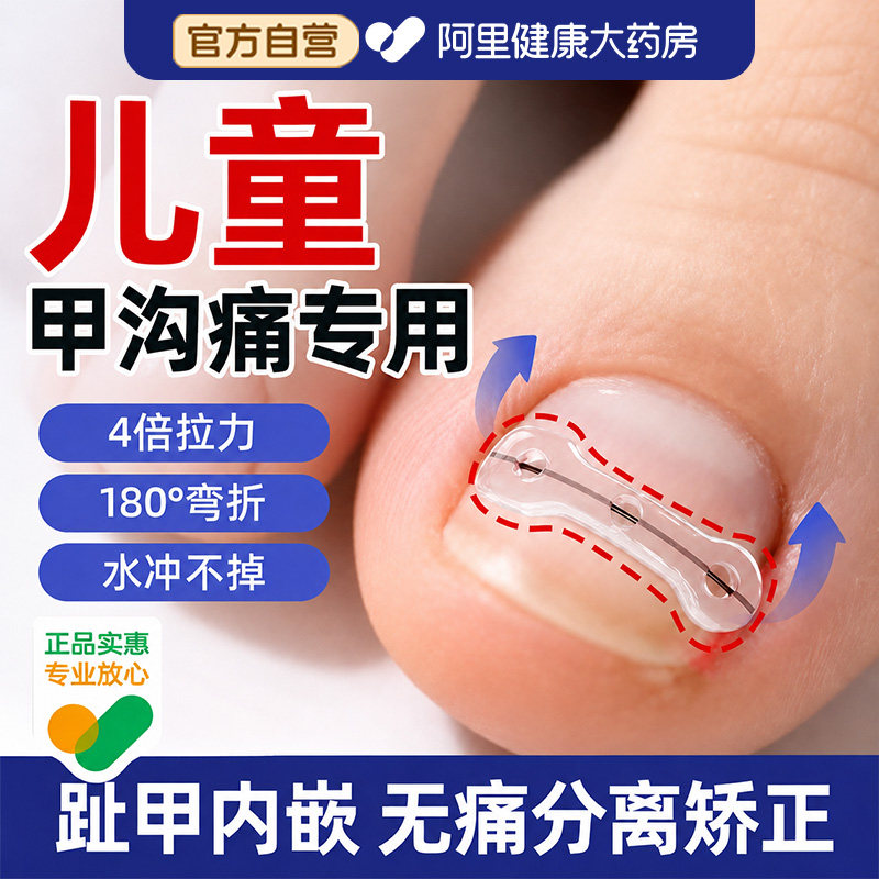 儿童专用甲沟嵌甲卷甲矫正器炎正甲贴脚趾甲贴片指甲往肉里长纠正