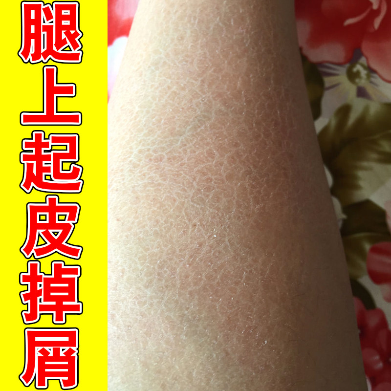 秋冬身上起皮干燥护理乳液鱼鳞质感肌肤舒缓粗糙全身长效保湿润肤