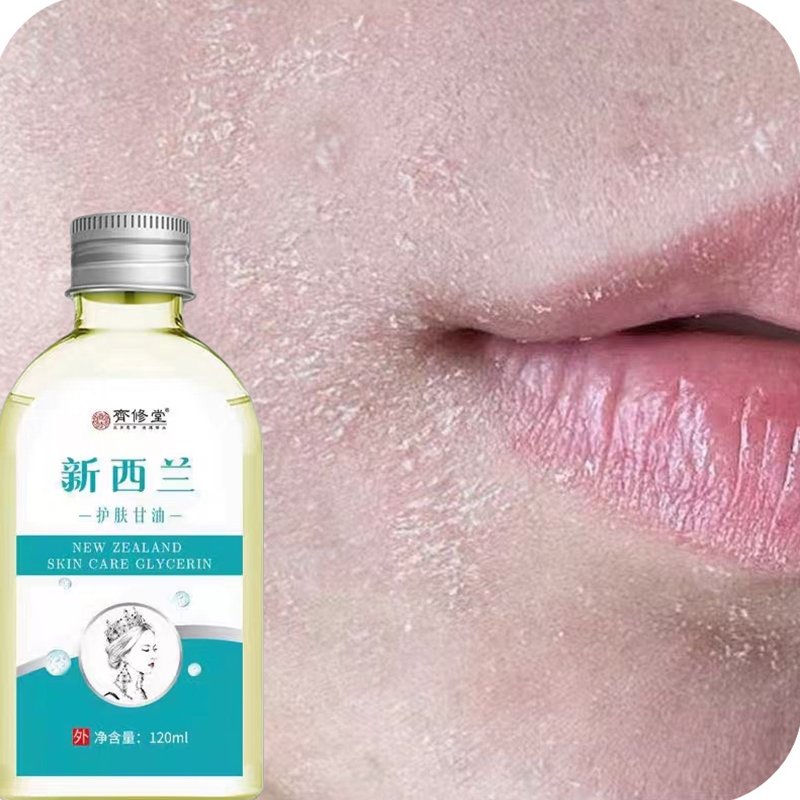嘴角两边干燥起皮嘴巴周围脱皮起皮掉皮干痒脸部起皮刺痒干皮乳膏