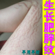 生长肥胖纹妊娠纹预防白色纹路青少年大腿跟上长红色纹专用修复药