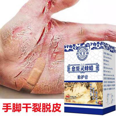 2盒装】手裂口指龟裂燥40478脚后跟干防干防裂修复霜皲裂脚裂克星