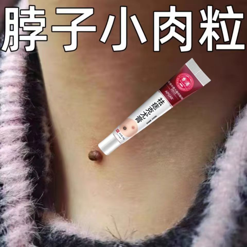 香港祛痣膏全身可用不留痕