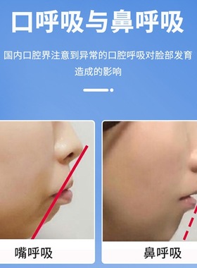 X型呼吸贴闭嘴贴 口呼吸贴矫正闭口贴防止睡觉张口张嘴呼吸止鼾贴