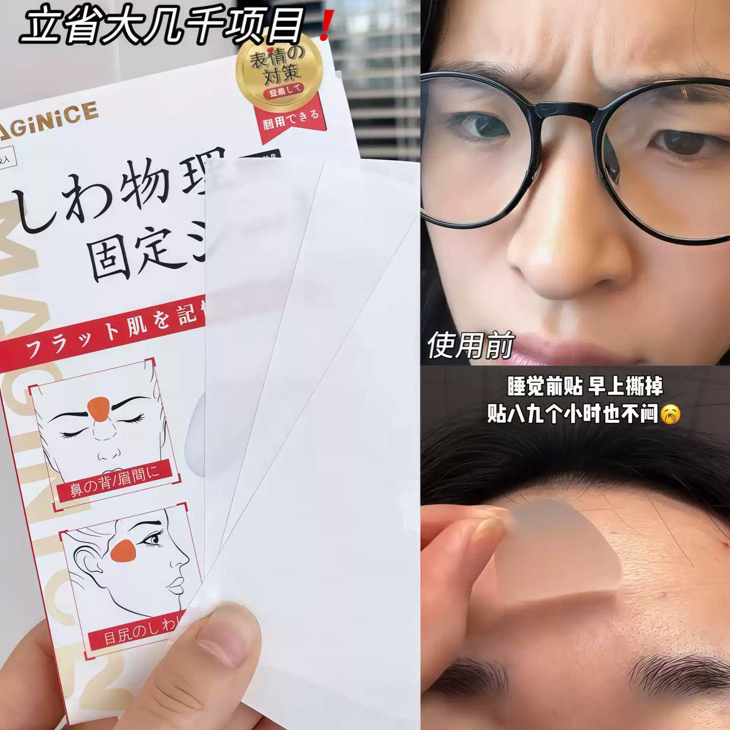 瞿颖同款！川字纹贴眉间头