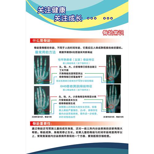 定制男孩女孩骨龄图谱骨密度检测重要性写真图背胶海报多图任选