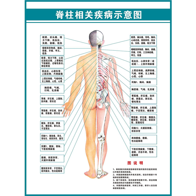 脊柱相关疾病示意图中医养生病理原因结构图图海报pp胶壁纸