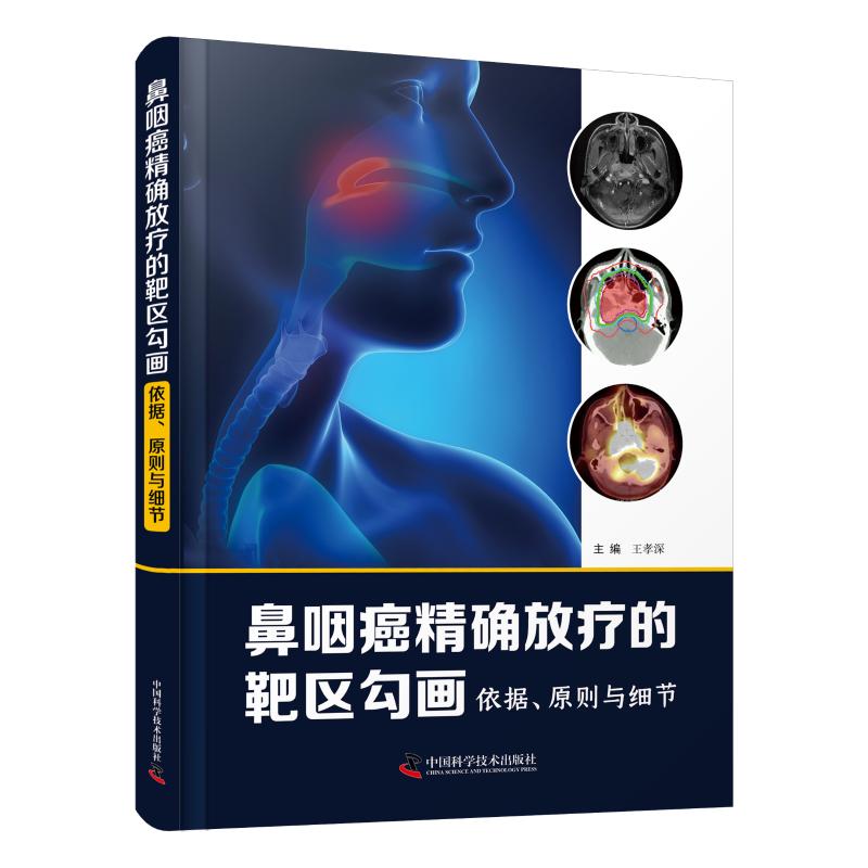 正版鼻咽癌精准放疗的靶区勾画：依据、原则与细节
