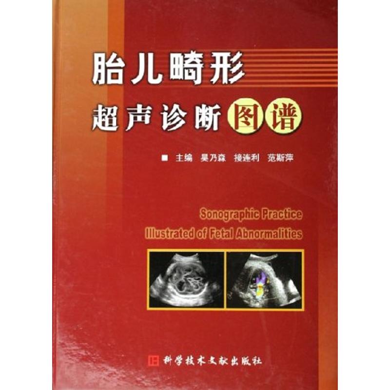 正版胎儿畸形超声诊断图谱