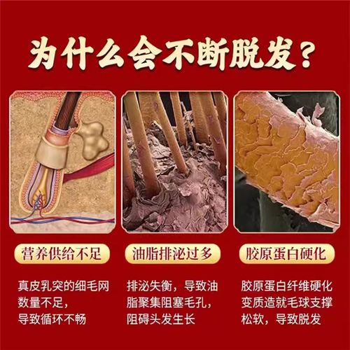 固肾生发丸同仁堂北京天麻何首乌片复方J地黄丸修正药业脱发生发