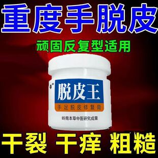 手足脱皮膏手掌脱皮痒开裂干燥脚后跟干裂手指脱皮水泡手痒止痒膏