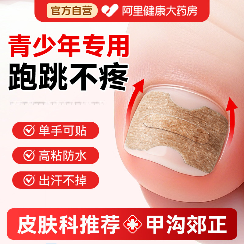甲沟矫正器正甲贴片嵌甲青少年脚指甲盖纠正器专用贴脚趾甲沟垫炎,家庭/个人清洁工具,美甲/修甲套装,淘宝优惠券,粉丝福利购,淘宝优惠卷