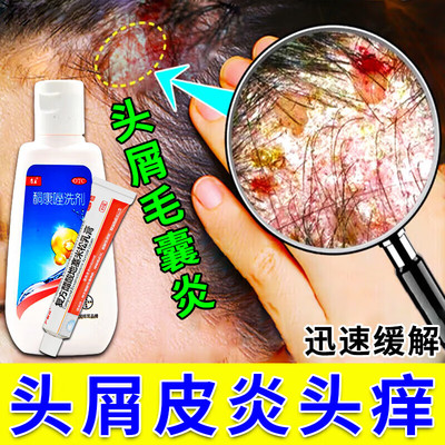 【康王】酮康唑洗剂2%*50ml/瓶