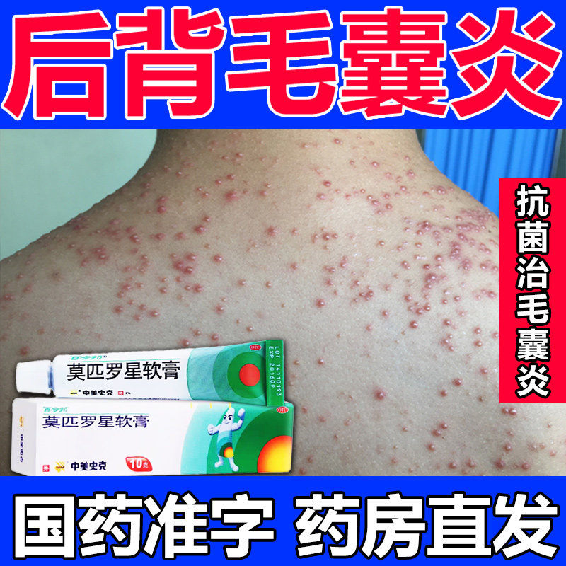 治疗毛囊炎专用药膏后背长痘痘脓红包痘药百多邦莫匹罗星软膏正品