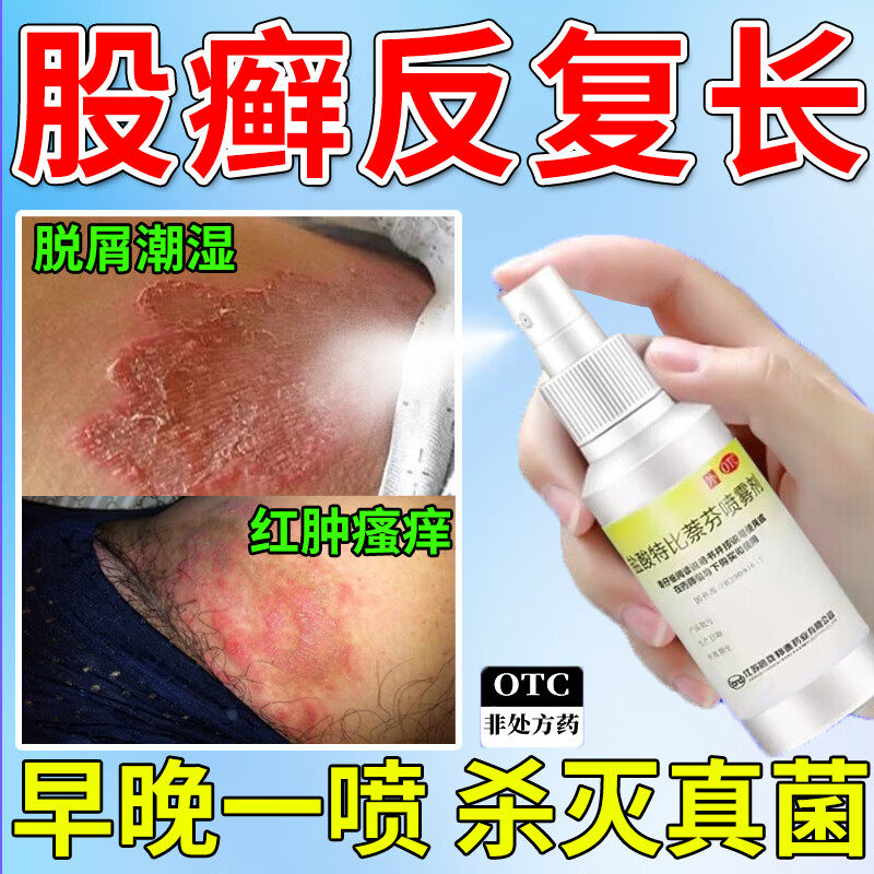 股藓专用药股癣大腿内侧皮肤瘙痒股藓止痒体癣盐酸特比萘芬喷雾剂