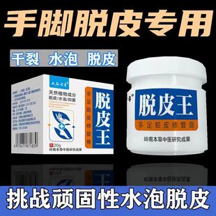 手足脱皮膏手掌脱皮痒开裂干燥脚后跟干裂手指脱皮水泡手痒止痒膏