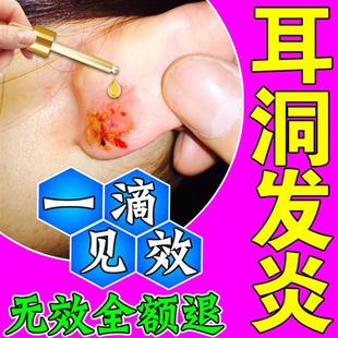 极速耳洞发炎护理液治红肿增生防耳D洞发炎消炎液流脓流水清洁神