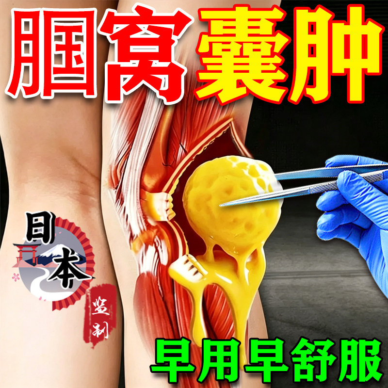 日本【腘窝囊肿】多买多送