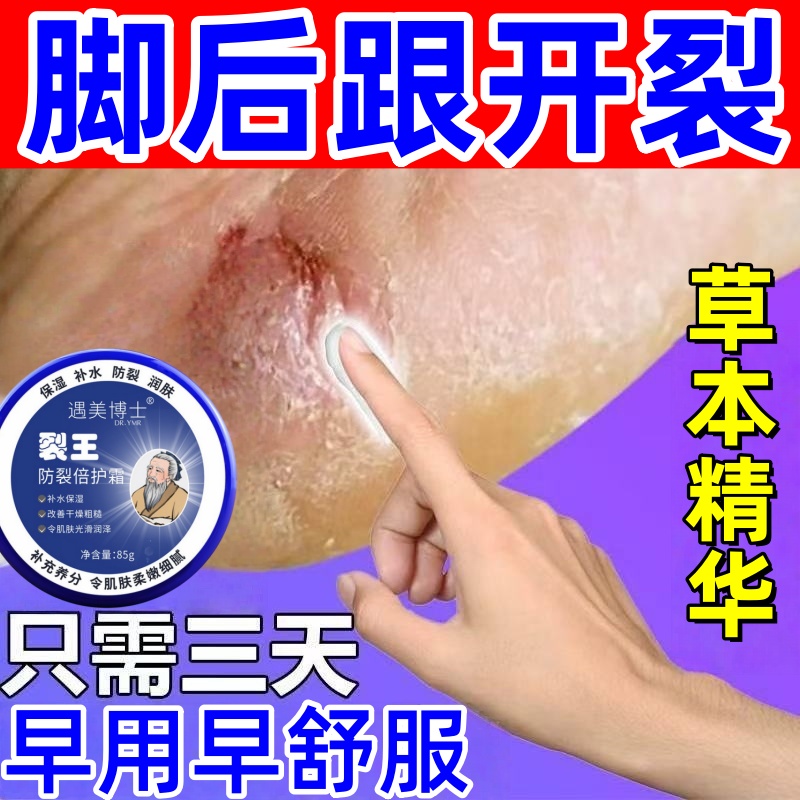 裂王抗裂修复霜脚后跟干裂起硬皮足跟开裂手足脱皮真菌感染皲裂膏