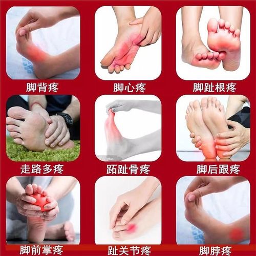 前脚掌疼痛贴脚底板o麻木肌肉韧带拉伤足底筋膜焱热敷神器专用药