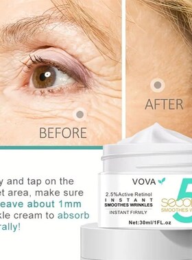 极速Body Wrinkle Remover Anti-aging Moisturizer IUnstant Fir