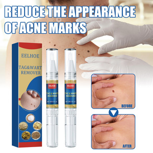 Mild Ingredients Body Skin Quyou Pen Cleansing Liquid Keyou