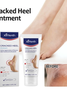 Dry cracked feet care cream repair heel calluses foot moistu