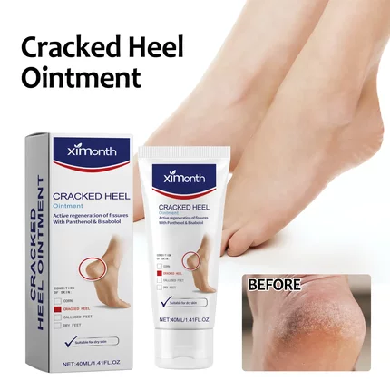 Dry cracked feet care cream repair heel calluses foot moistu