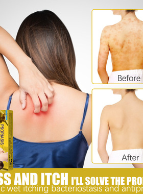 Skin Care Ointment Moisturizes and Repairs Body Skin. Extern