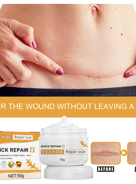 Skin care cream protects the body skin, which is soft, smoot