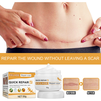 EELHOE皮肤护理膏呵护身体肌肤