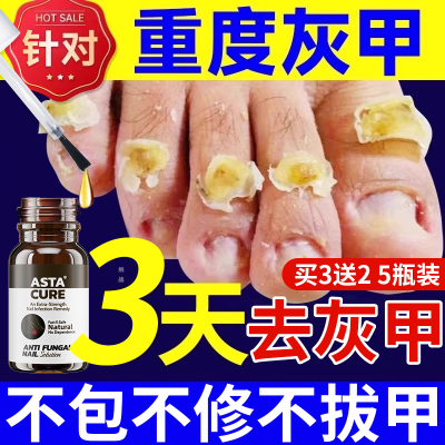 自营astacure灰指甲特效药